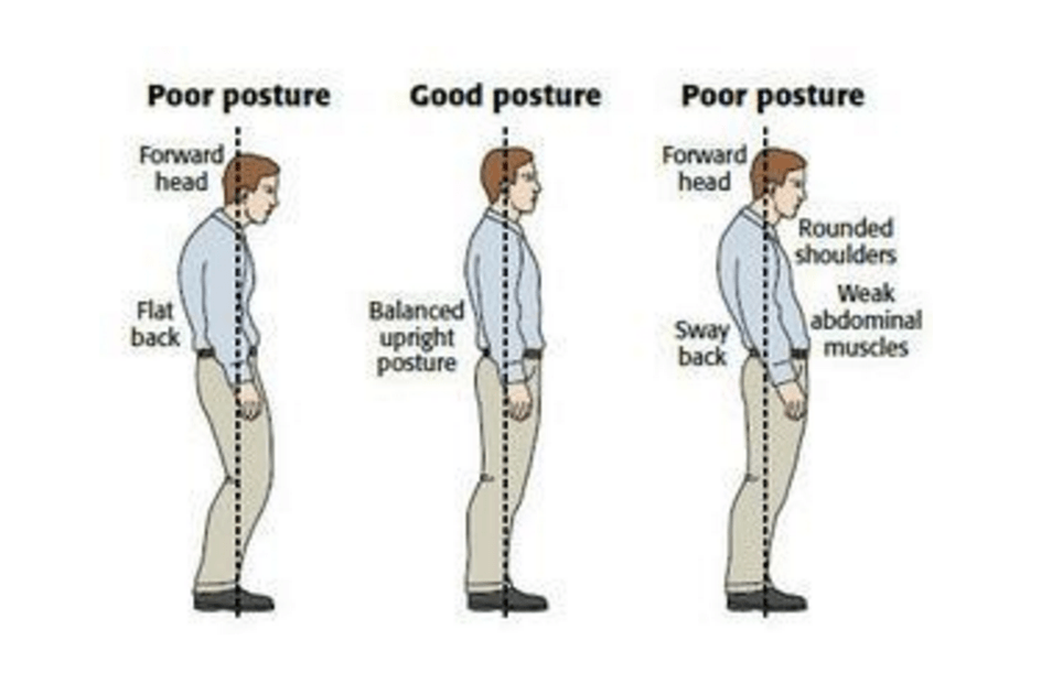 Fuente de la imagen: http://www.thephysiocompany.com/blog/stop-slouching-postural-dysfunction-symptoms-causes-and-treatment-of-bad-posture