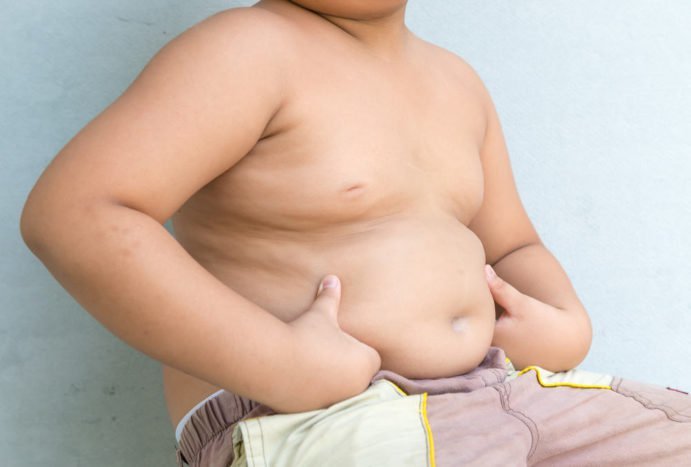 obesidad en niños