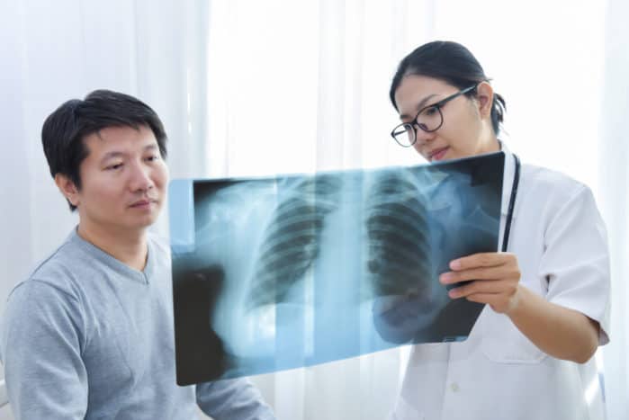 enfermedad pulmonar intersticial