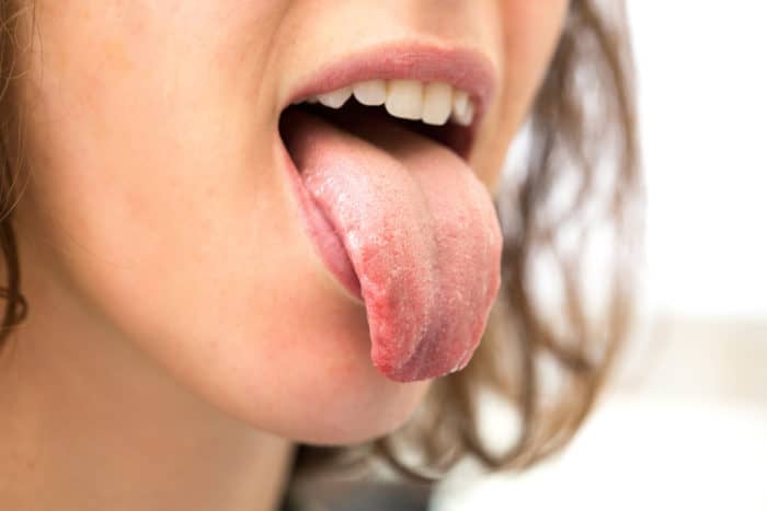 la causa de la comezón en la lengua