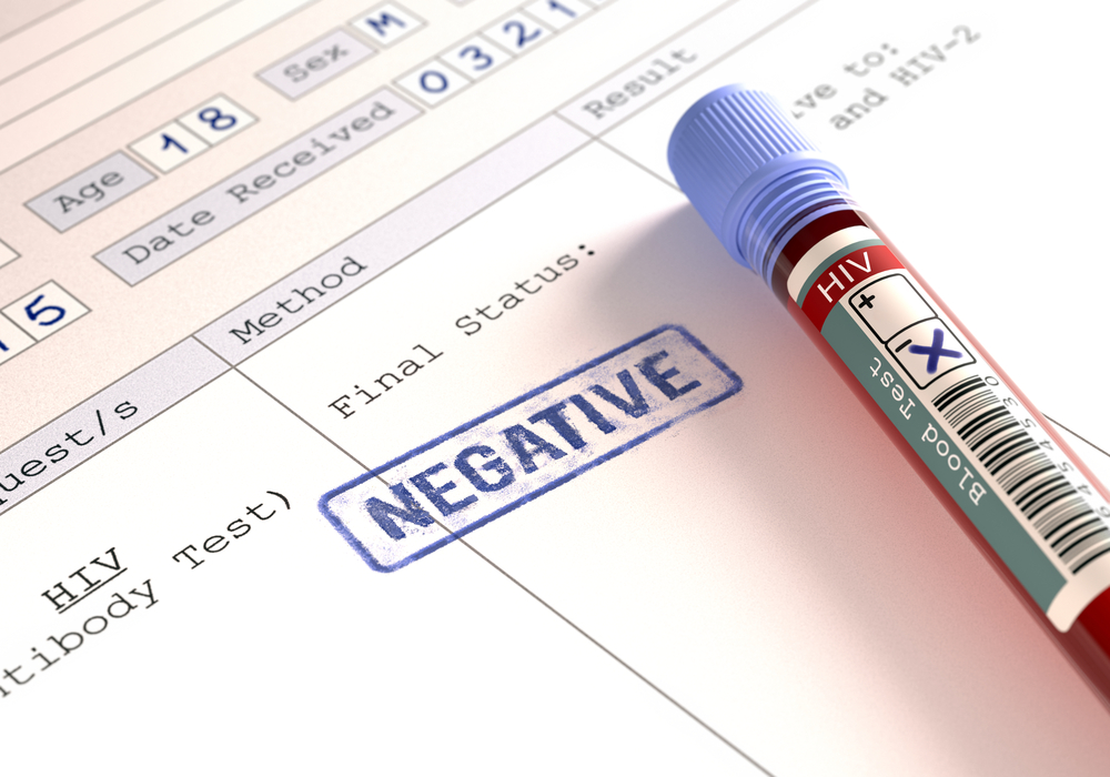 El significado de los resultados de una prueba de VIH negativa.