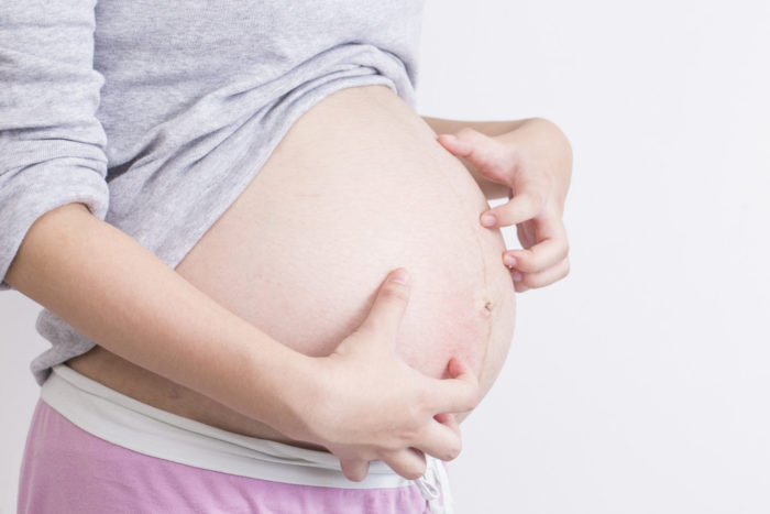La foliculitis prurítica es la causa de picazón en la piel durante el embarazo