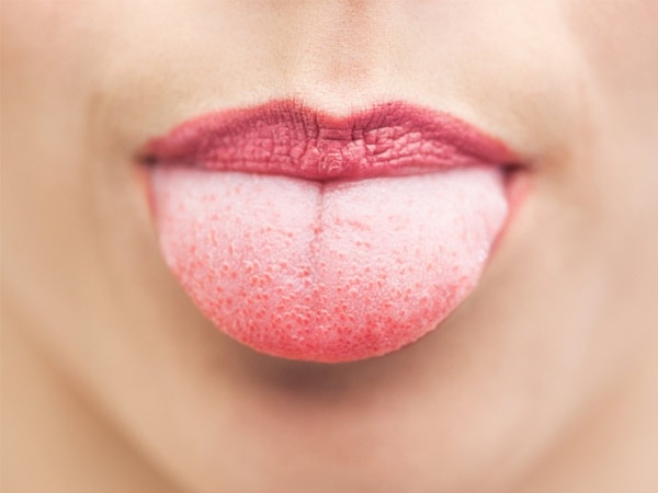 El color de la lengua significa enfermedad.